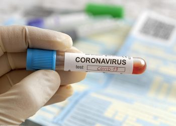 Covid-19: Brasil tem 4.195 mortes registradas em 24 horas