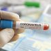 Covid-19: Brasil tem 4.195 mortes registradas em 24 horas
