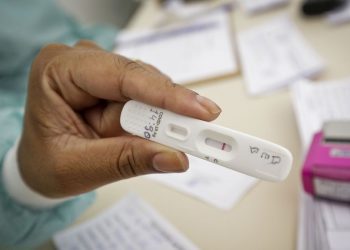 Anvisa aprova uso e comercialização de autotestes para covid-19