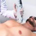 Espaçolaser